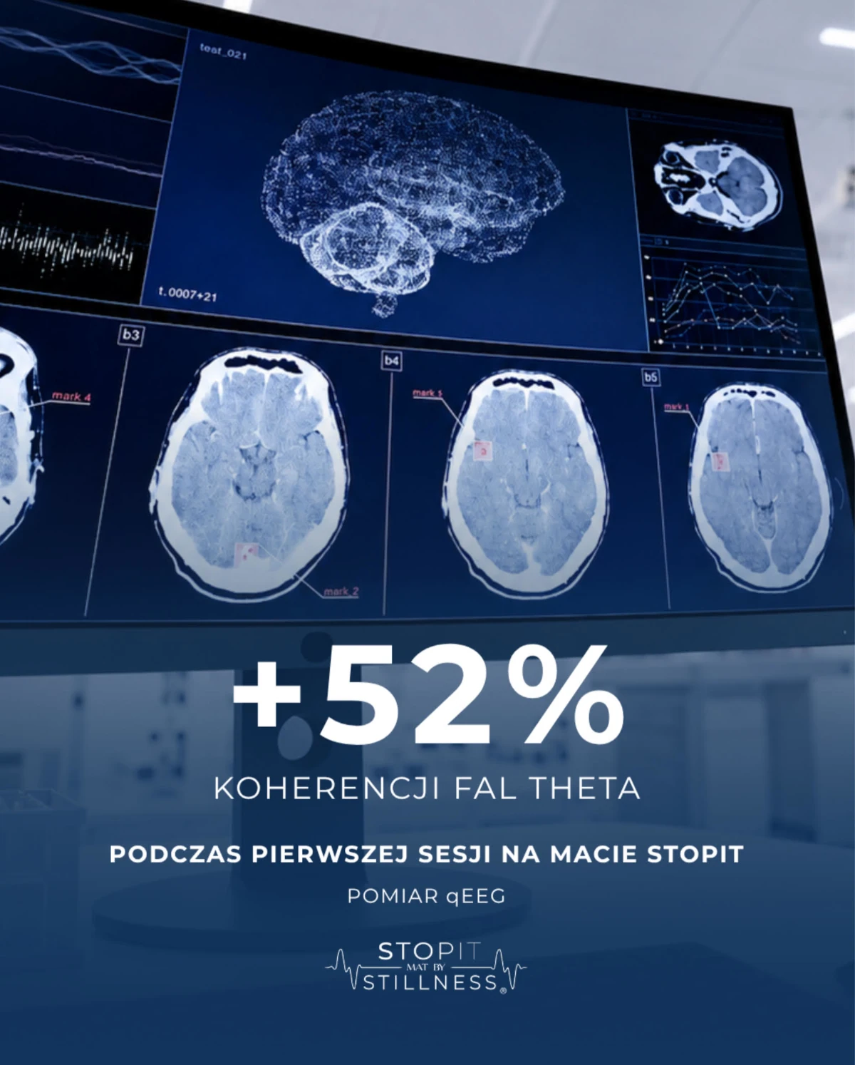 pomiar qEEG-EKG